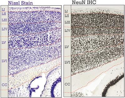 Transcriptional and Post-Transcriptional Mechanisms of the Development of Neocortical Lamination